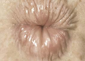 Kiss my ass / Une campagne qui ne restera pas dans les annales?